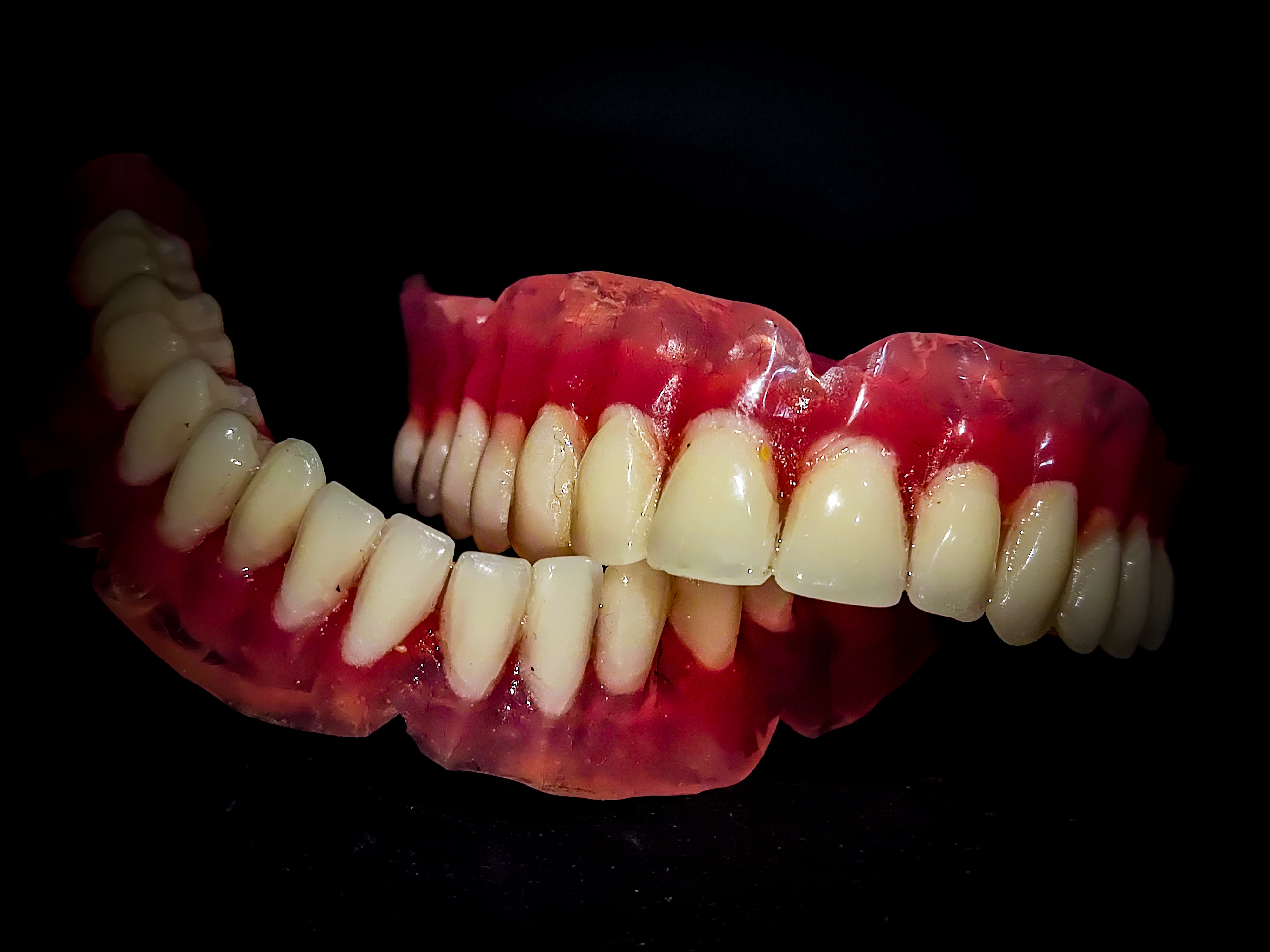 Complete Dentures